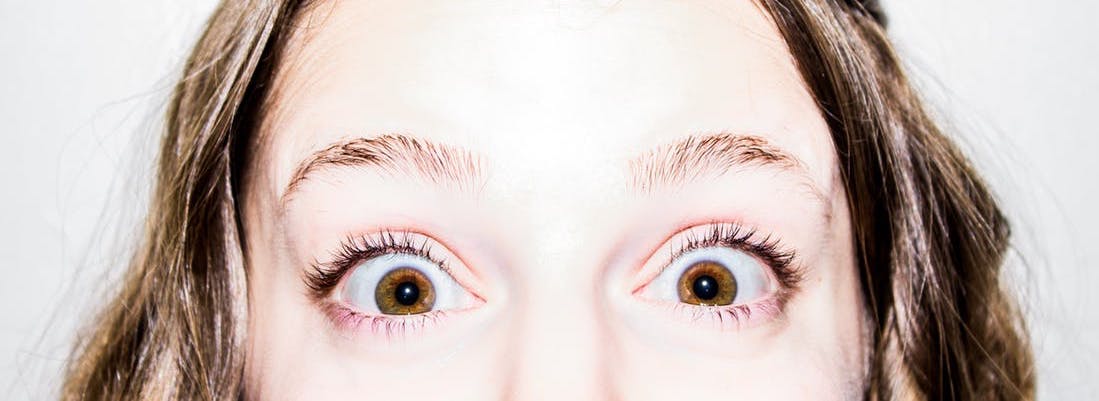 how to prevent wrinkles around the eyes